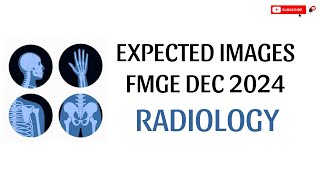 RADIOLOGY IMAGES FMGE DEC 2024 [upl. by Salohcin]