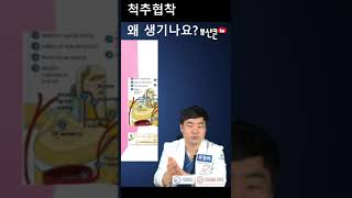 척추협착증은 왜 생기나요 목디스크 부산큰병원 양방향내시경 [upl. by Emelyne]