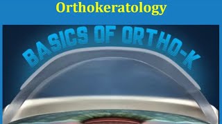 Orthokeratologyaka  Ortho K lenses Optometry Lecture by Seema Kumari CL Gupta Eye Institute [upl. by Melvyn]