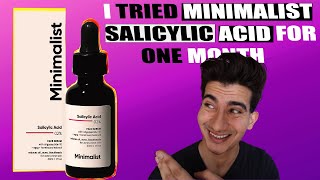 I Tried minimalist Salicylic Acid For A Month Is It Worth It  CHEMICAL EXFOLIANT [upl. by Kcitrap]