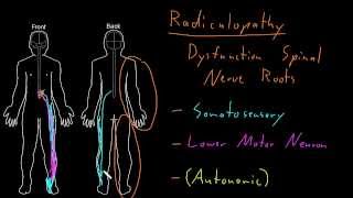 Syndrome Radiculopathy [upl. by Cirdec]