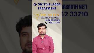 Q Switch Laser Treatment Meachine DrSai Prasanth Neti skincare skincondition [upl. by Ahto448]