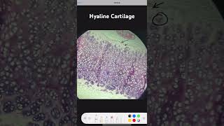 Hyaline Cartilage [upl. by Laehcor]