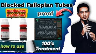 Blocked Fallopian Tubes ka ilaaj by Dr Mustafa blockedfallopiantubes treatment homeopathy facts [upl. by Helas]