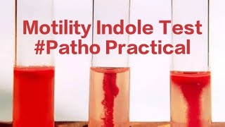 Motility Indole Patho Bacterial Motility Indole test [upl. by Penni]