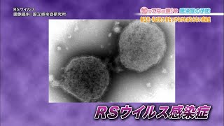 【赤ちゃん要注意！】RSウイルス感染症「知ってなっ得！感染症の予防＃４その４」 [upl. by Blau]