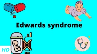 Edwards Syndrome Causes Signs and Symptoms Diagnosis and Treatment [upl. by Htiel436]