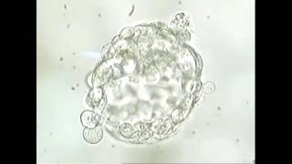 Study of Zona Free Oocyte Microinjection and Embryo development [upl. by Sommers]