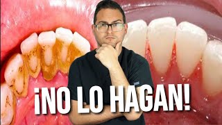 ¿Quitar el SARRO de los DIENTES en 2 minutos 😎 Elimina la PLACA DENTAL ❌🙄 [upl. by Alejo]