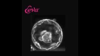 Embryo Development Day 5 Using The Eeva Test [upl. by Constantine]