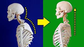 FIX Your Forward Head Posture in 5 Minutes a Day [upl. by Josh]