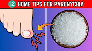 12 Essential Home Tips for Treating Paronychia A Comprehensive Guide  The Health Place [upl. by Eneloj357]