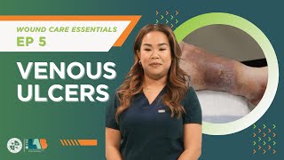 Wound Care Essentials Video 5 – Venous Ulcers [upl. by Golter]