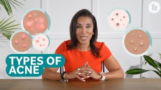 The Different Types of Acne and How to Treat Them [upl. by Radcliffe263]