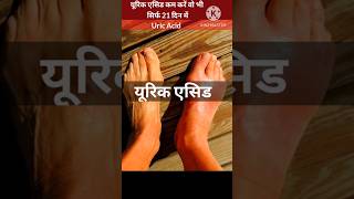 Uric Acid ka ilaj  How to reduce Uric Acid  Uric Acid Treatment shorts short ayurveda ytshort [upl. by Irrot]