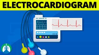 What is an Electrocardiogram EKGECG SIMPLE Explanation [upl. by Neik]