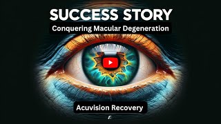 Breakthrough Macular Degeneration Treatment Success Story [upl. by Eyatnod164]