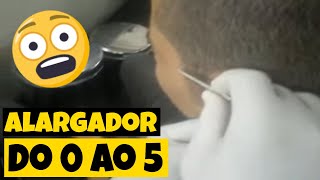 Alargador Furando Orelha  De 0 a 5mm em Segundos [upl. by Miranda654]