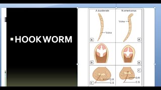 Parasitology 200 a Hookwormancylostoma duodenalenecator americanus [upl. by Fitalludba]