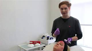 Microneedling with Mesotherapy  The Laser and Skin Clinic [upl. by Francoise]