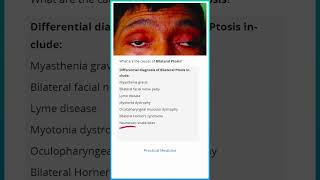 Causes of Bilateral Ptosis [upl. by Wynnie]