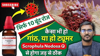 ट्यूमर या गांठ की रामबाण दवा  Homeopathic Medicine Scrophularia Nodosa Q  Scrophula Nodosa Q Uses [upl. by Aslin]