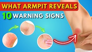 What Your Armpit Tells About Your Health 10 Warning Signs  Lump  Lymph Nodes  Armpit Pain [upl. by Ellekim]