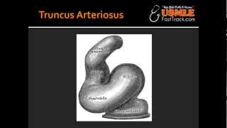 Truncus Arteriosus [upl. by Yrovi]