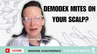 DEMODEX MITES ON MY SCALP TREATMENT SYMPTOMS ROOT CAUSES [upl. by Julissa]