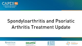 Spondyloarthritis SpA and Psoriatic Arthritis PsA Treatment Update [upl. by Beghtol]