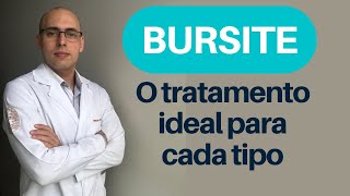 VOCÊ ESTÁ TENDO O TRATAMENTO CORRETO PARA SUA BURSITE [upl. by Osric]