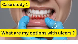 Mouth Ulcers amp Bleeding Gums The Solutions You Need [upl. by Chrysler]