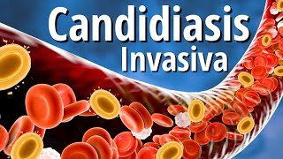 Candidiasis Invasiva Explicada Claramente [upl. by Kahl]