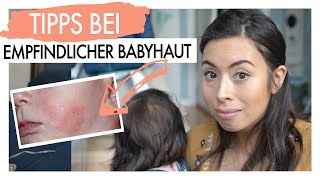 NEURODERMITIS EKZEM BEI BABIES I TIPPS BEI EMPFINDLICHER BABYHAUT  EILEENA [upl. by Onailime689]