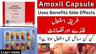 Amoxil Capsule Uses In Urdu  Amoxil Capsule 500mg  Amoxil Capsule 250 mg [upl. by Kobe565]