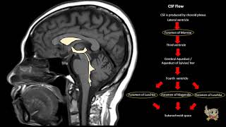 SYNAPSE 101 How to read a MRI Brain [upl. by Bamford]