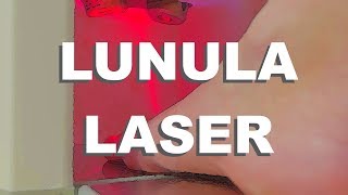 Lunula Laser  Fungal Infection Removal With Lasers [upl. by Refennej]