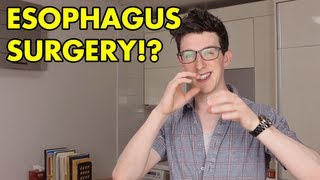 ESOPHAGUS SURGERY [upl. by Aibos705]