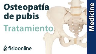 Cómo tratar la Osteopatía de pubis Quirúrgico y conservador [upl. by Laise]