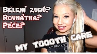 Bílé zuby sama doma Rovnátka [upl. by Atreb]