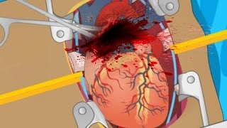 HEART SURGERY Flash Game [upl. by Sedicla]