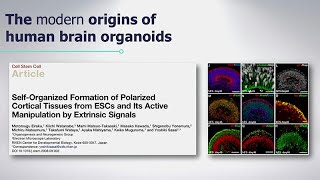 Rescuing Phenotypes in PTHSDerived Brain Organoids with Alysson Muotri [upl. by Ardin]