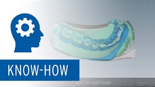 Impression Scan Tutorial with Ceramill Map Scanners [upl. by Kwok]