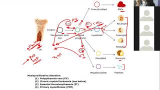 Hematology 11a  Myeloproliferative neoplasms [upl. by Slaby]