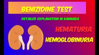 Benzidine test detailed explanation in KannadaBlood in urineDMLTBMLT [upl. by Enirolf969]