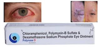 Dexamethasone eye ointment  Polynase D  uses  Optometry solution [upl. by Aihsenek375]