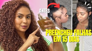 APENAS TRÊS INGREDIENTES O CABELO CRESCE MUITO E NÃO CAI NÃO USE MUITO [upl. by Rianon]