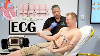 What Is ECG ElectrocardiogramEKG Indications How It Is Done And Basic Principles [upl. by Soiritos756]