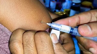 Arms Injection video Intramuscular im Suma Ject Injection pushসল্প বিরতি করনে ইনজেকশন  24 P02 [upl. by Robillard854]