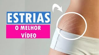 ESTRIAS O MELHOR VÍDEO  DICAS DA DEDESSA [upl. by Woods70]